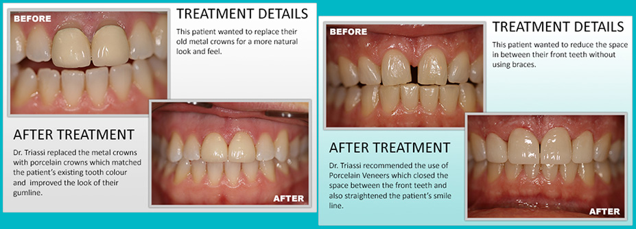 West Village Dental - Contact
